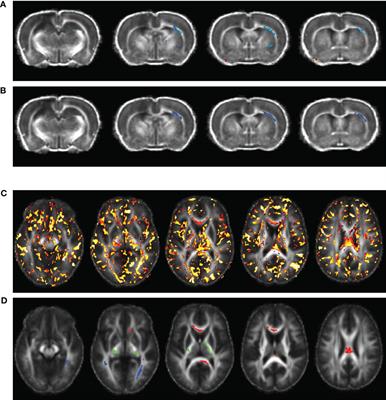 Diffusion tensor imaging and plasma immunological biomarker panel in a rat traumatic brain injury (TBI) model and in human clinical TBI